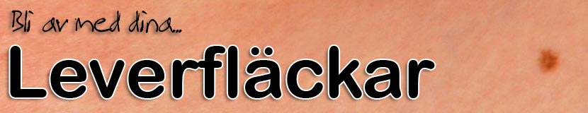 Leverfläckar